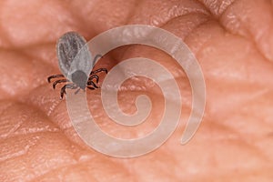 Biting castor bean tick with hypostom penetrating a skin and outstretched palps. Ixodes ricinus