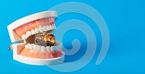 A bitten chocolate bar in a dental jaw mockup on a blue background. The concept of sweets harming tooth enamel, caries