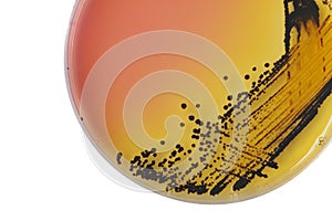 Black bacterial colonies of Salmonella species on Salmonella Shigella agar (SS agar, selective and differential medium) plate on photo