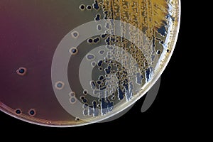 Black bacterial colonies of Salmonella species on Salmonella Shigella agar (SS agar, selective and differential medium) plate on