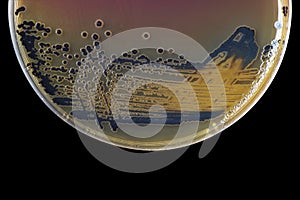 Black bacterial colonies of Salmonella species on Salmonella Shigella agar (SS agar, selective and differential medium) plate on