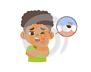 A black boy V.2 has a toothache because of tooth decay. illustration cartoon character vector design on white background. kid and