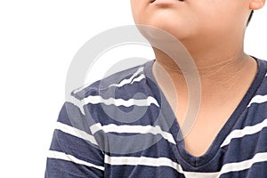 Black marks of the skin around the neck  of fat boy