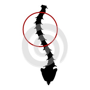 Black and white silhouette icon scoliosis. Spinal curvature, kyphosis, lordosis of the neck, scoliosis, arthrosis