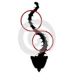 Black and white silhouette icon scoliosis. Spinal curvature, kyphosis, lordosis of the neck, scoliosis, arthrosis