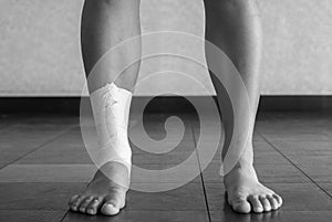 Black and white version of Ankle tape job on an athleteâ€™s ankle