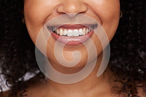 Black woman, teeth and smile for dental care, whitening or oral and mouth treatment. Closeup of happy African American