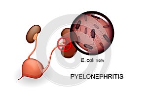 Bladder and kidneys. pyelonephritis