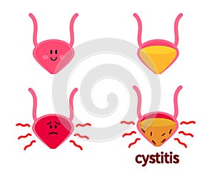 Bladder on a white background. Cystitis. Symbol. Vector