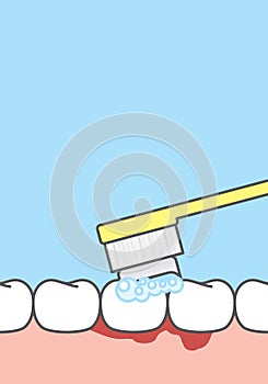 Blank banner Bleeding when brushing illustration vector on blue background. Dental concept