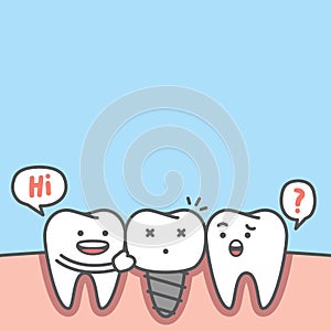 Blank banner dental cartoon of white teeth real root and implant screw metal root illustration cartoon character vector design on