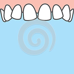 Blank banner Upper askew teeth illustration vector on blue background. Dental concept