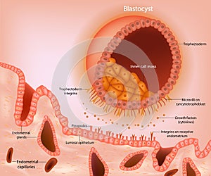 Blastocyst implantation. A schematic representation of a blastocyst approaching the receptive endometrium. Appearance of photo