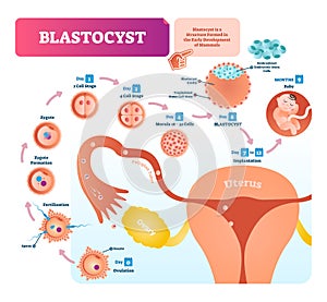 Blastocyst vector illustration infographic. Biological embryo early stage.