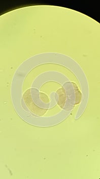 Blastomeres of mammalian egg, microscopic photo