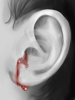 Bleeding ear digital art