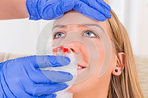 Bleeding nose emergency