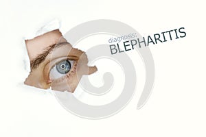 Blepharitis disease poster with blue eye on left photo