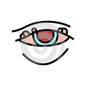 blepharitis disease, redness of eyeball color icon vector illustration