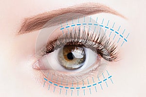 Blepharoplasty treatment, plastic surgery, face lift concept. Female eye close up photo