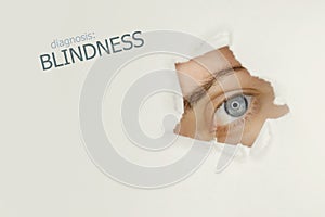 Blindness disease poster with blue eye on right.