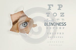 Blindness disease poster with eye test chart and blue eye on left