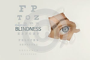 Blindness disease poster with eye test chart and blue eye on right