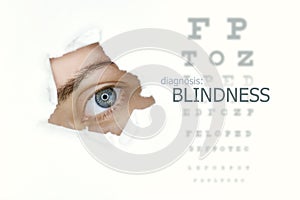 Blindness disease poster wwith eye test chart and blue eye on left