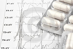 Blister with white pills on EKG graph. Medicine