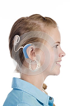 Blond girl with cochlear implant photo