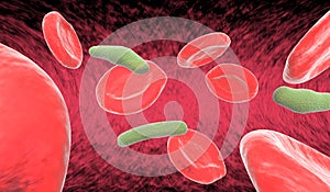 Blood cells and bacteria in artery
