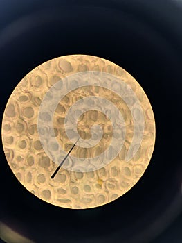 blood cells and expression of mitosis and meiosis of cells