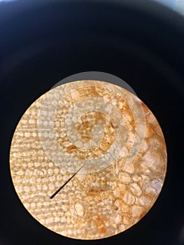 blood cells and expression of mitosis and meiosis of cells