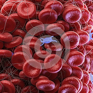 A blood clot