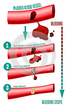 Blood clot formation