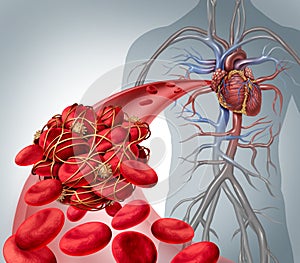 Blood Clot Risk