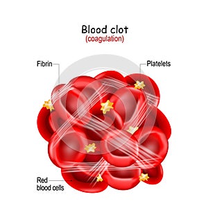 Blood clot structure. thrombus photo