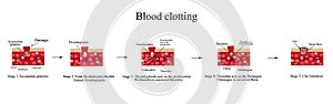 Blood clotting. Infographics. Vector illustration