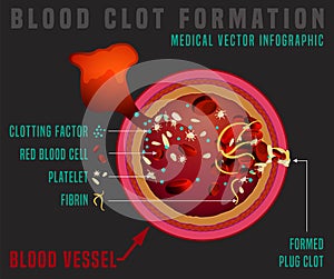 Blood clotting process
