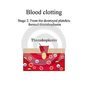 Blood clotting. Stage 2. Infographics. Vector illustration