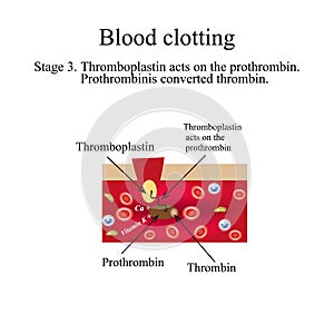 Blood clotting. Stage 3. Infographics. Vector illustration