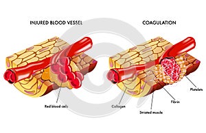 Sangre coagulación 