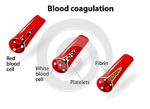 Blood coagulation