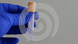 Blood collection container. Hand in blue nitrile glove. Empty blood test tube