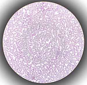 Blood film showing a decrease of platelets