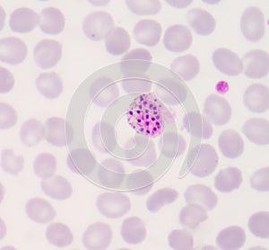 Blood films for Malaria parasite