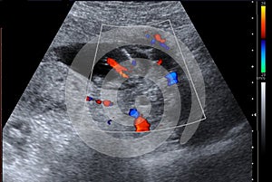 Blood flow in placenta