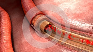 Blood Flow in vessels