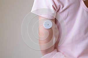 Blood glucose sensor on the arm of a child. Sensor for remote measurement of blood glucose levels using NFC technology