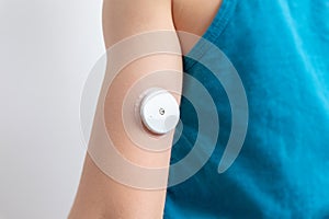Blood glucose sensor on a child`s arm. Sensor for remote measurement of blood glucose levels using NFC